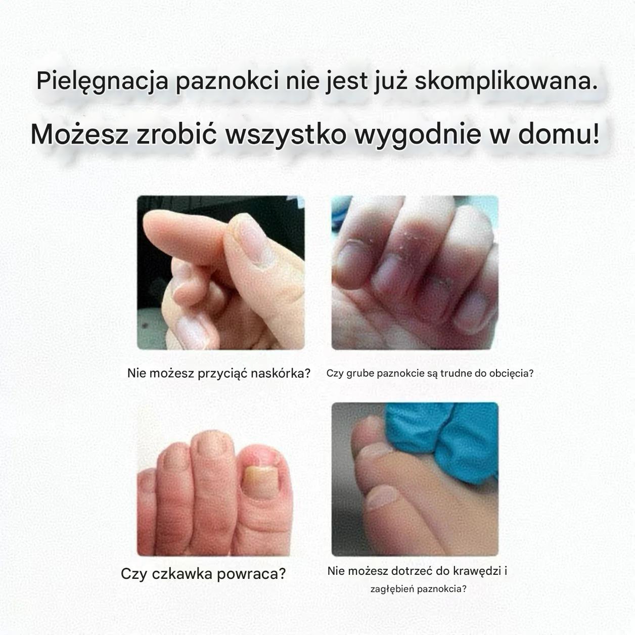 Ergonomiczne cążki do paznokci dla seniorów｜Łatwo radzą sobie z twardymi i grubymi paznokciami – ✨Drugi produkt za pół ceny✨